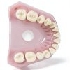 Dental Implant Tooth Model Smile1000 28 Teeth with Soft Gingiva-4