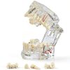Ceonam adult dental model life size acrylic with detachable teeth-0