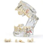 Ceonam adult dental model life size acrylic with detachable teeth-0