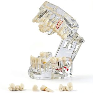 Ceonam adult dental model life size acrylic with detachable teeth-0