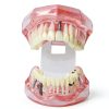 Dental Implant Model 2001P by XINGXING Fixed Prosthetic Demo Kit-3