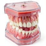 Dental Model Ceonam Silica Gel Removable Teeth Educational Kit-0