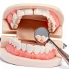 RHUI Adult Typodont 28 Non‑Removable Teeth Model Set-2