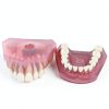 Dental Implant Tooth Model Smile1000 28 Teeth with Soft Gingiva-7