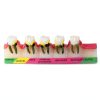 ZITREOXN Soft Skin Periodontitis Dental Model Resin 5‑Stage-3