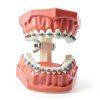 Dentalmall Silicone Dental Model 1:1 Tooth Replica with Braces-3