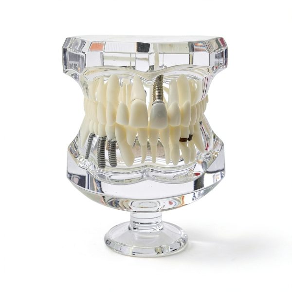 Ceonam adult dental model life size acrylic with detachable teeth-2