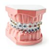 Ceonam Orthodontic Dental Model Silicone Braces Educational Typodont-0