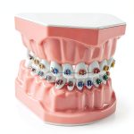 Ceonam Orthodontic Dental Model Silicone Braces Educational Typodont-0