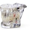 Dental Implant Model 2001C by Dentalmall Fixed Prosthetic Kit-5