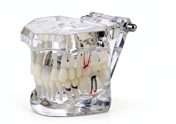 Dental Implant Model 2001C by Dentalmall Fixed Prosthetic Kit-5