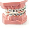 Dentalmall Silicone Dental Model 1:1 Tooth Replica with Braces-5