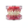 Witbee Premium Silicone Dental Model with Removable Teeth-1