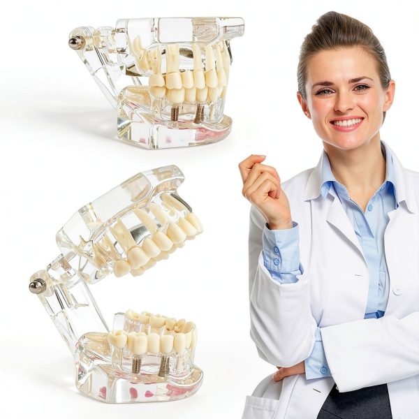 Ceonam adult dental model life size acrylic with detachable teeth-4