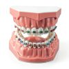 Dentalmall Silicone Dental Model 1:1 Tooth Replica with Braces-0