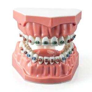 Dentalmall Silicone Dental Model 1:1 Tooth Replica with Braces-0