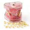 DentalMall Silica Gel Dental Model #4004 01 with Removable Teeth-4