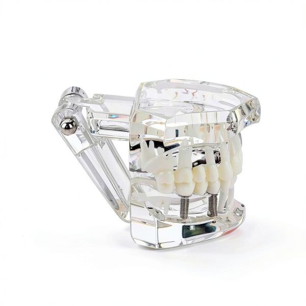 Dental Implant Model 2001C by Dentalmall Fixed Prosthetic Kit-4