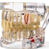 Dental Implant Model 2001C by Dentalmall Fixed Prosthetic Kit-1