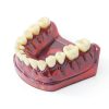 Dental Implant Tooth Model Smile1000 28 Teeth with Soft Gingiva-8