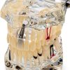 Dental Implant Model 2001C by Dentalmall Fixed Prosthetic Kit-2