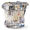 Dental Implant Model 2001C by Dentalmall Fixed Prosthetic Kit-6