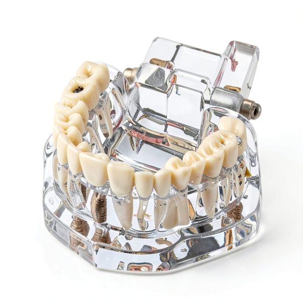 Ultrassist Transparent Dental Model UL0150 Full Mouth Teaching Aid-1