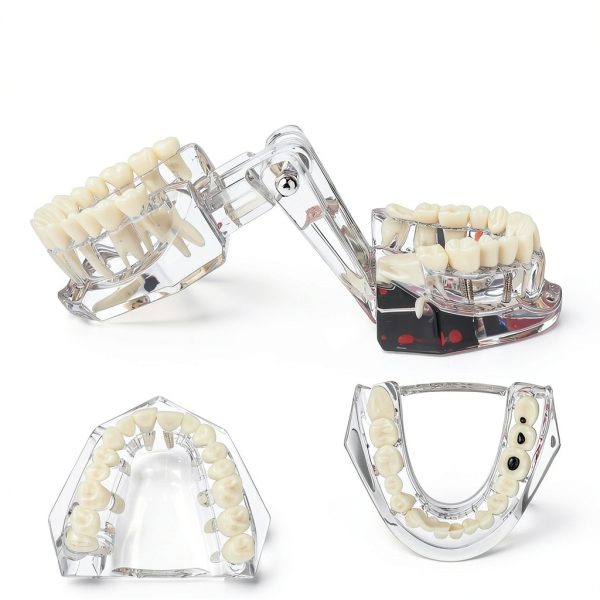 Ultrassist Transparent Dental Model UL0150 Full Mouth Teaching Aid-3