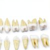 Xingxing Dental Model Teeth Set 28 Artificial Teeth for Beginners-6