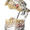 Dental Implant Model 2001C by Dentalmall Fixed Prosthetic Kit-0