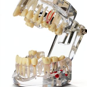 Dental Implant Model 2001C by Dentalmall Fixed Prosthetic Kit-0