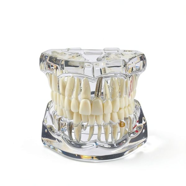 Ultrassist Transparent Dental Model UL0150 Full Mouth Teaching Aid-4