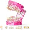 Outus Pink Dental Pathology Tooth Model 2.76" x 2.48" Size 1-0