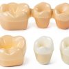 Dental Model QWORK Resin Metal with Magnet Stability Removable Crowns-4