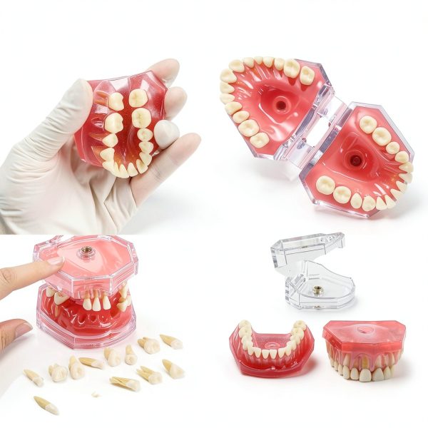 Dental Model Ceonam Silica Gel Removable Teeth Educational Kit-2