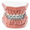 Dentalmall Silicone Dental Model 1:1 Tooth Replica with Braces-2