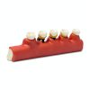 Dentalmall Periodontitis Model 4010 Cross Section Dental Educational-4