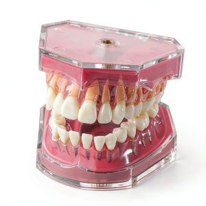 DentalMall Silica Gel Dental Model #4004 01 with Removable Teeth-0