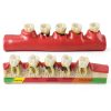 Dentalmall Periodontitis Model 4010 Cross Section Dental Educational-1