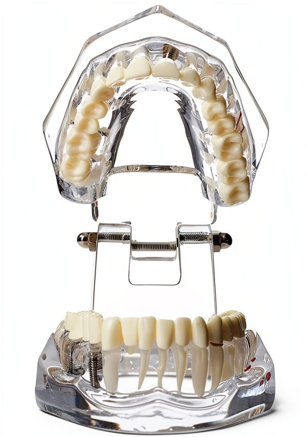 Dental Implant Model 2001C by Dentalmall Fixed Prosthetic Kit-3