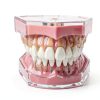 Dental Implant Tooth Model Smile1000 28 Teeth with Soft Gingiva-6