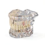 Ultrassist Transparent Dental Model UL0150 Full Mouth Teaching Aid-0