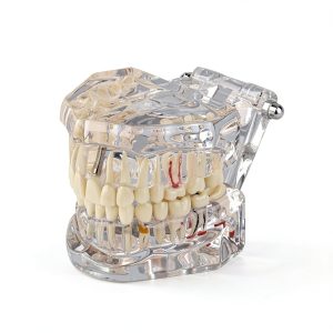 Ultrassist Transparent Dental Model UL0150 Full Mouth Teaching Aid-0