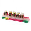 ZITREOXN Soft Skin Periodontitis Dental Model Resin 5‑Stage-2