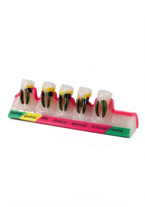 ZITREOXN Soft Skin Periodontitis Dental Model Resin 5‑Stage-2