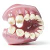 Dental Implant Tooth Model Smile1000 28 Teeth with Soft Gingiva-5