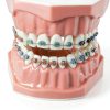 Dentalmall Silicone Dental Model 1:1 Tooth Replica with Braces-4