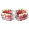 Dental Implant Tooth Model Smile1000 28 Teeth with Soft Gingiva-3